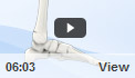 Ankle Fracture