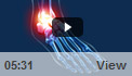 Ankle Sprain
