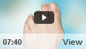 Bunion Surgery