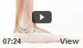 Common Toe Deformities