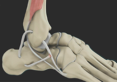 Tendon Reconstruction