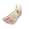 Ankle Cartilage Injury