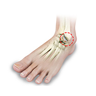 Foot and Ankle Arthritis