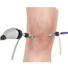 Knee Arthroscopy