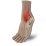 Sports Foot and Ankle Injuries