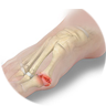 Toe Arthritis